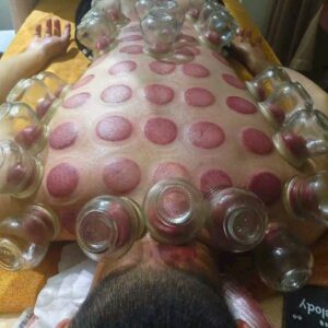 Body massage cupping da nang service at home with herbal treatment to ease body pain, reduce stress, boost circulation, and provide deep relaxation.